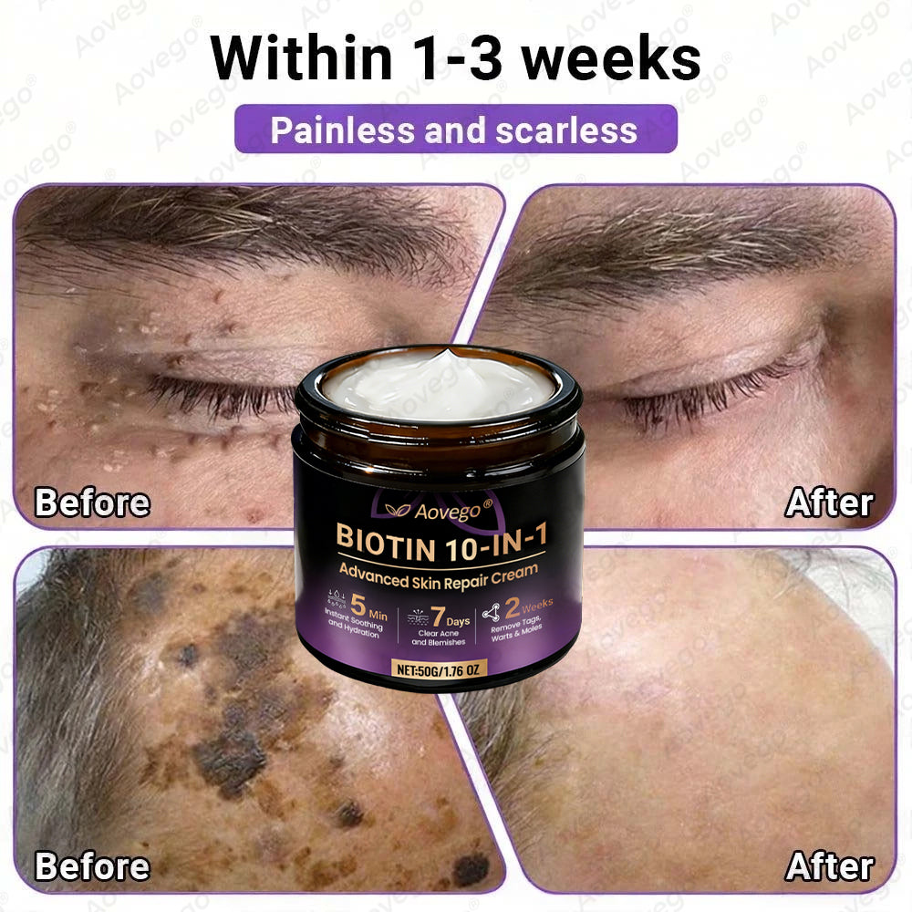Made and Shipped from UK ✨Aovego® BIOTIN 10-IN-1  Advanced Skin Repair Cream🌻