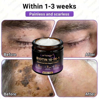 Made and Shipped from UK ✨Aovego® BIOTIN 10-IN-1  Advanced Skin Repair Cream🌻