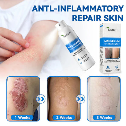 ✅ Official Store: KUBOZN® Magnesium Herbal Psoriasis & Eczema – Fast-Acting, Steroid-Free Relief (OFFER)