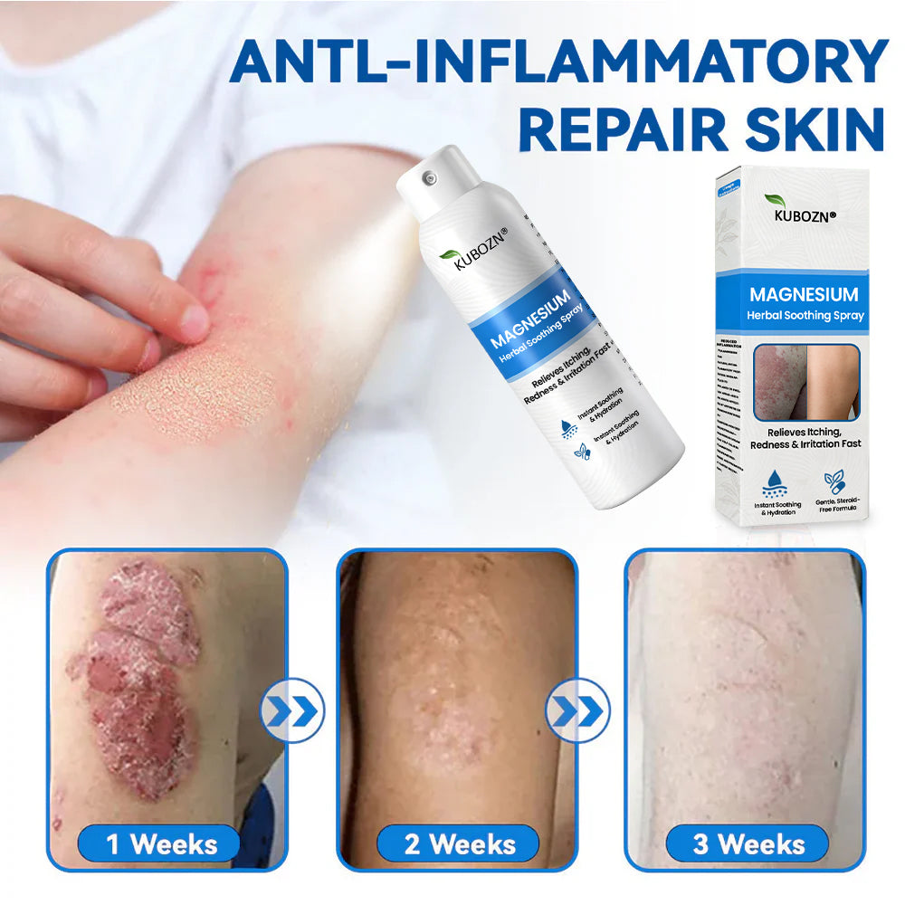 🔥KUBOZN® Magnesium Spray – Fast Relief for Itchy, Red & Sensitive Skin (Even Intimate Areas)