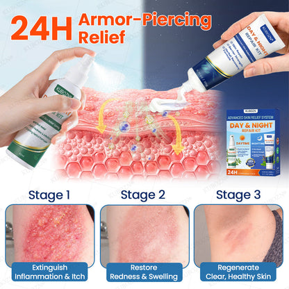 KUBOZN® Eczema Day & Night Repair System - 100% Steroid-Free Relief Duo for Intense Itch, Redness & Broken Skin