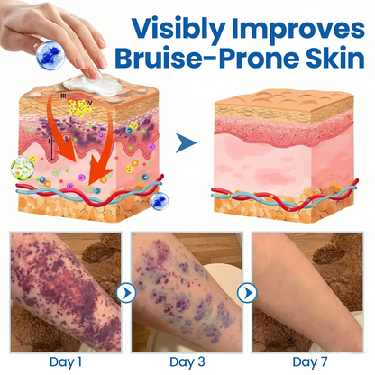 KUBOZN® Fragile Skin Repair Cream🛡️🌿 Multi-Repair for Bruises, Dryness & Spots