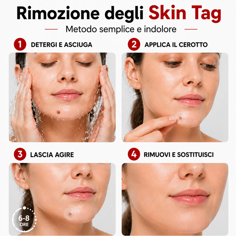 KUBOZN® Pro MicroDarts TAG — Patch per Fibromi Cutanei