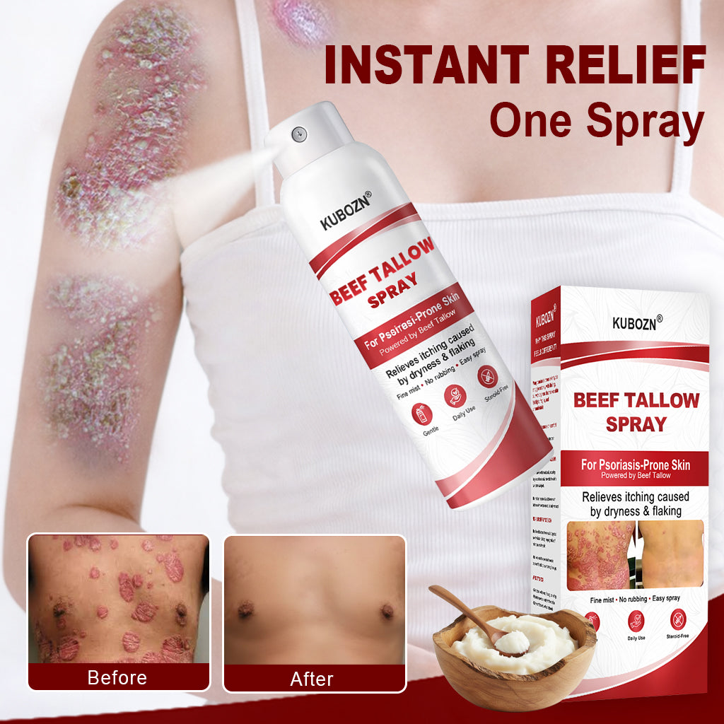 KUBOZN® Beef Tallow Spray — The No-Rub Relief for Psoriasis-Prone Skin✨