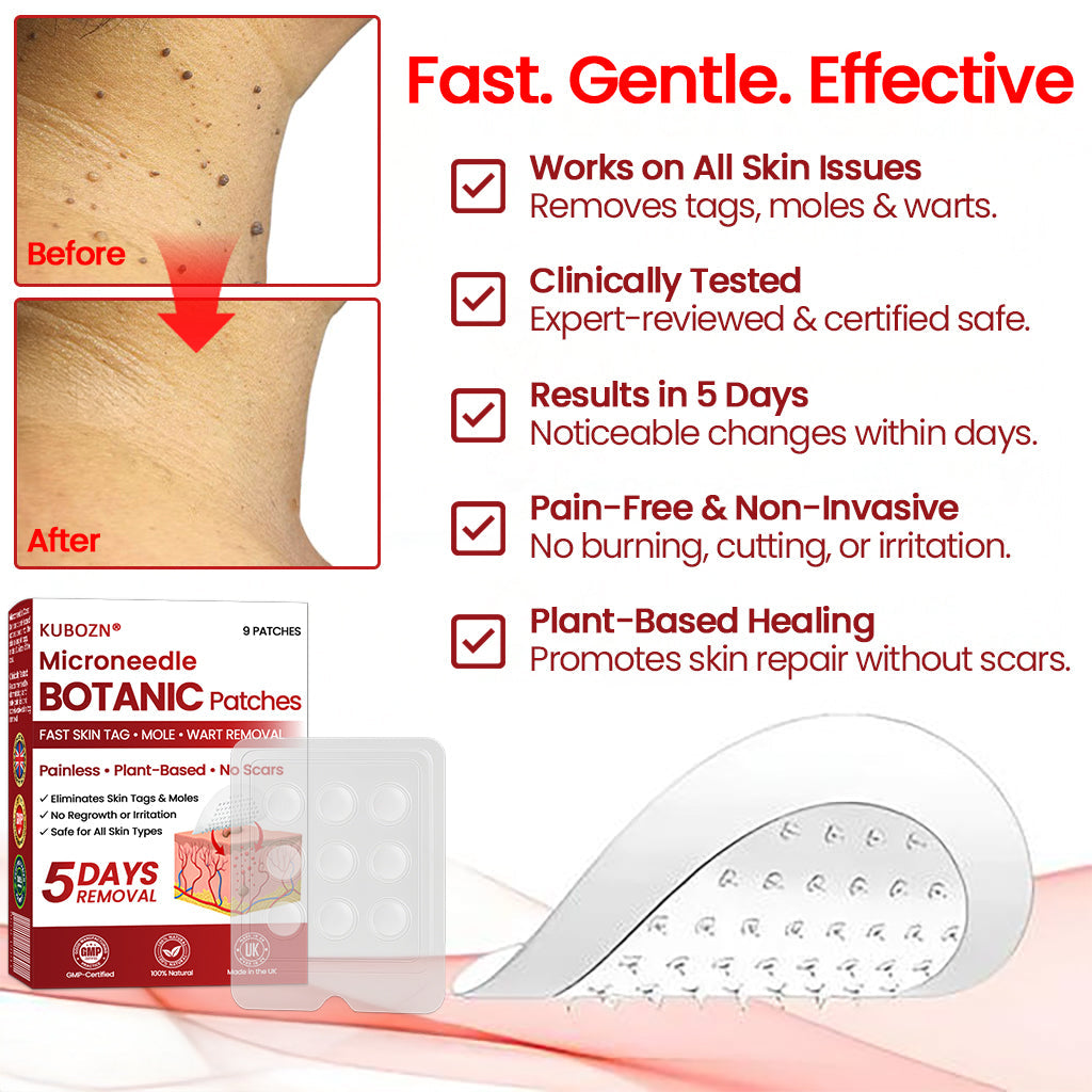 🔥 KUBOZN® Microneedle Skin Tag Removal Patches – Visible Results in 5 Days 🅱︎