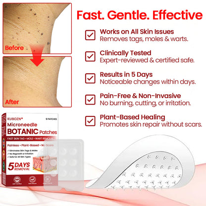 🔥 KUBOZN® Microneedle Skin Tag Removal Patches – Visible Results in 5 Days 🅱︎