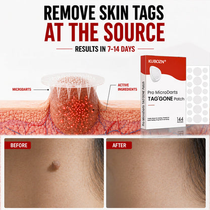 KUBOZN® Pro MicroDarts TAG™ — Patch per Fibromi Cutanei (offer)
