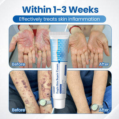 KUBOZN® Fragile Skin Repair Cream🛡️🌿 Multi-Repair for Bruises, Dryness & Spots