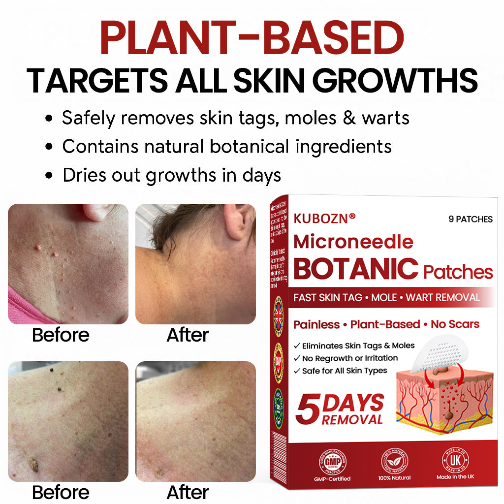 🔥 KUBOZN® Microneedle Skin Tag Removal Patches – Visible Results in 5 Days 🅱︎