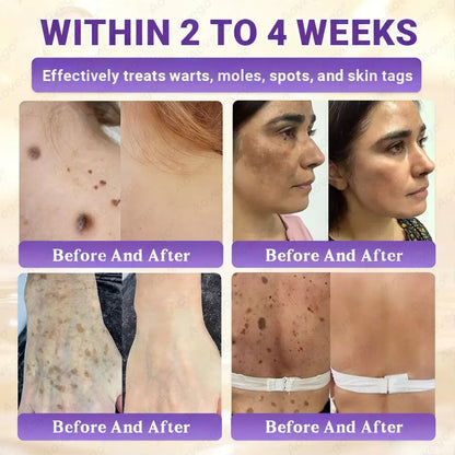 Made and Shipped from UK ✨Aovego® BIOTIN 10-IN-1  Advanced Skin Repair Cream🌻