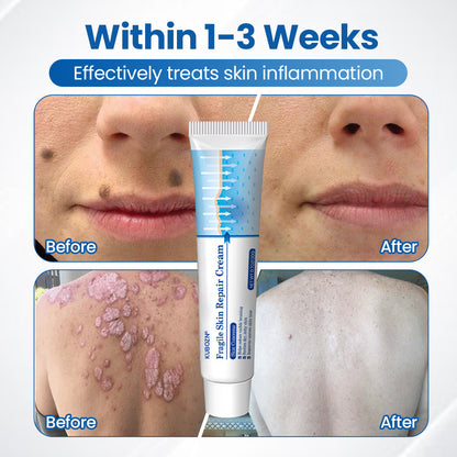 KUBOZN® Fragile Skin Repair Cream🛡️🌿 Multi-Repair for Bruises, Dryness & Spots
