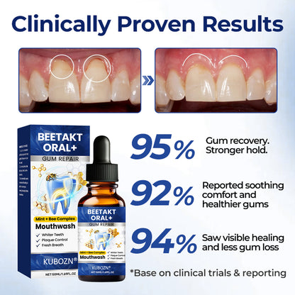 KUBOZN® BeeTakt Oral+ Gum Repaire Solution✨