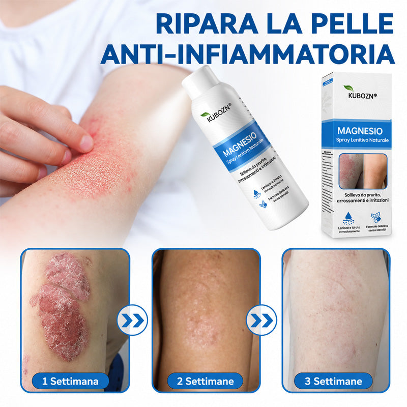 KUBOZN® Spray al Magnesio — Sollievo Rapido per Psoriasi ed Eczema