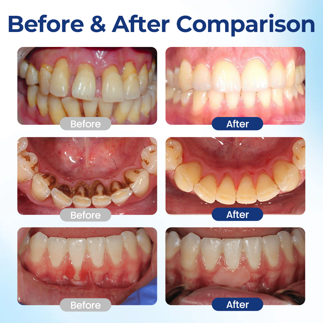 KUBOZN® BeeTakt Oral+ Gum Repaire Solution✨