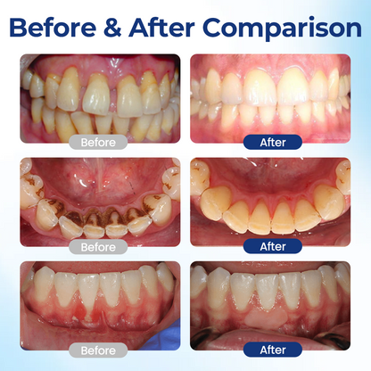 KUBOZN® BeeTakt Oral+ Gum Repaire Solution✨