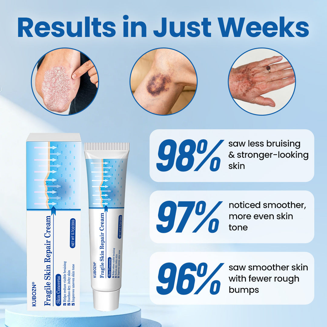 KUBOZN® Fragile Skin Repair Cream🛡️🌿 Multi-Repair for Bruises, Dryness & Spots