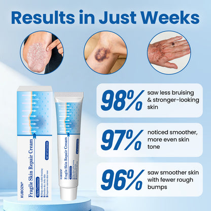 KUBOZN® Fragile Skin Repair Cream🛡️🌿 Multi-Repair for Bruises, Dryness & Spots