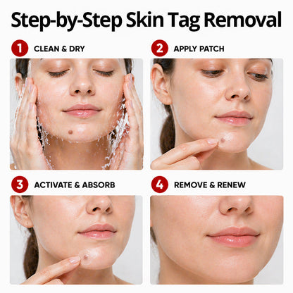 KUBOZN® Pro MicroDarts TAG™ — Patch per Fibromi Cutanei (offer)