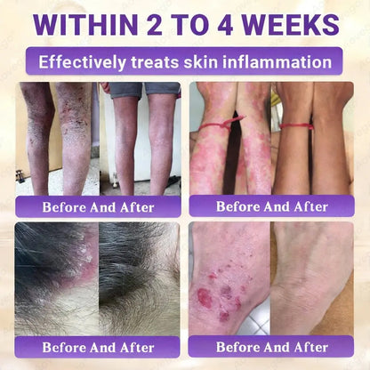 Made and Shipped from UK ✨Aovego® BIOTIN 10-IN-1  Advanced Skin Repair Cream🌻