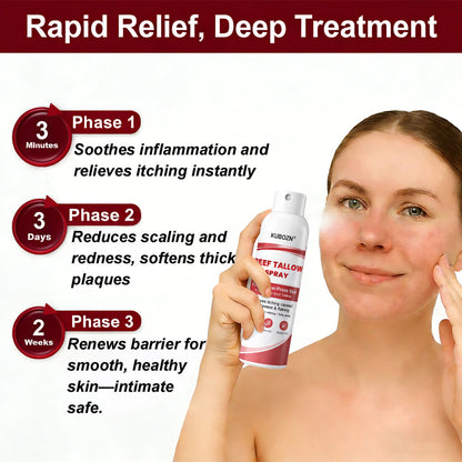 KUBOZN® Beef Tallow Spray — The No-Rub Relief for Psoriasis-Prone Skin✨