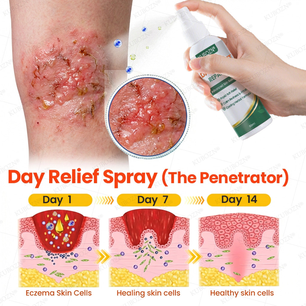 KUBOZN® Eczema Day & Night Repair System - 100% Steroid-Free Relief Duo for Intense Itch, Redness & Broken Skin
