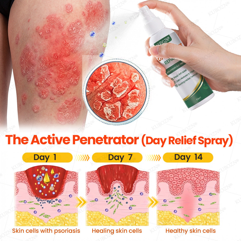 KUBOZN® 3-Min Itch Relief Psoriasis Cream – Steroid-Free Day & Night Treatment for Flaking, Scaling & Plaques