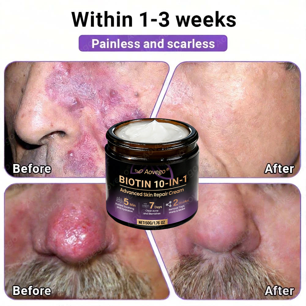 Made and Shipped from UK ✨Aovego® BIOTIN 10-IN-1  Advanced Skin Repair Cream🌻