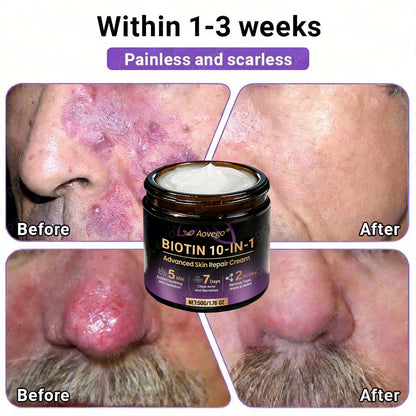 Made and Shipped from UK ✨Aovego® BIOTIN 10-IN-1  Advanced Skin Repair Cream🌻