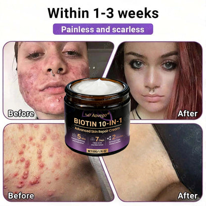 Made and Shipped from UK ✨Aovego® BIOTIN 10-IN-1  Advanced Skin Repair Cream🌻