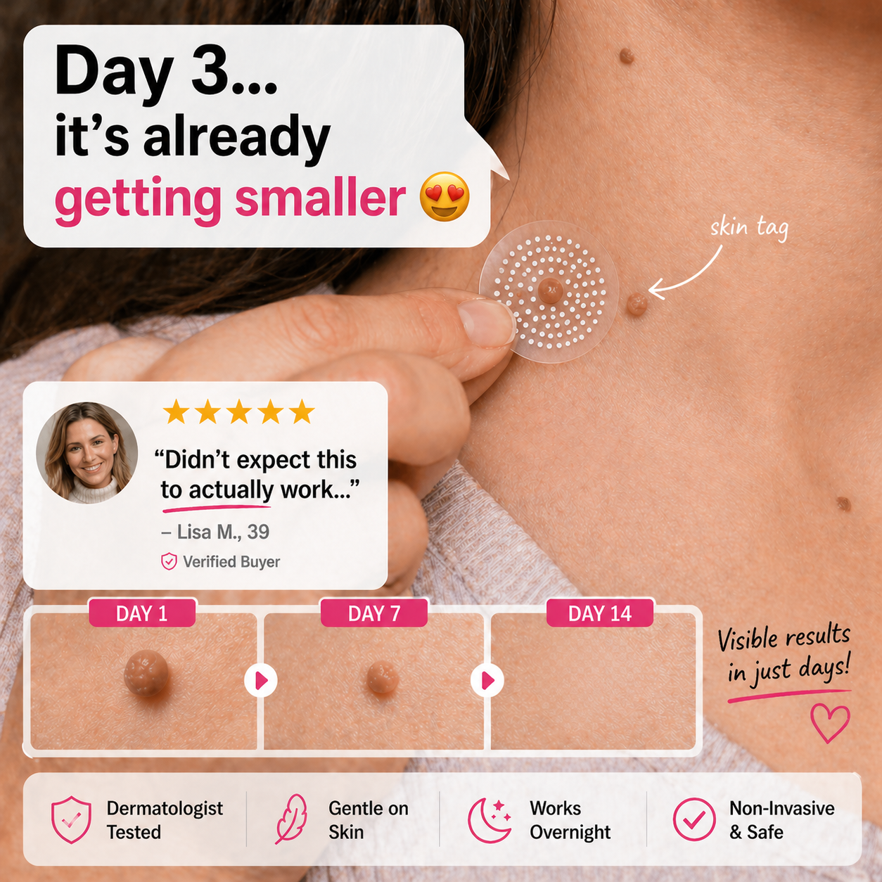 KUBOZN® Pro MicroDarts TAG™ — Patch per Fibromi Cutanei (offer)