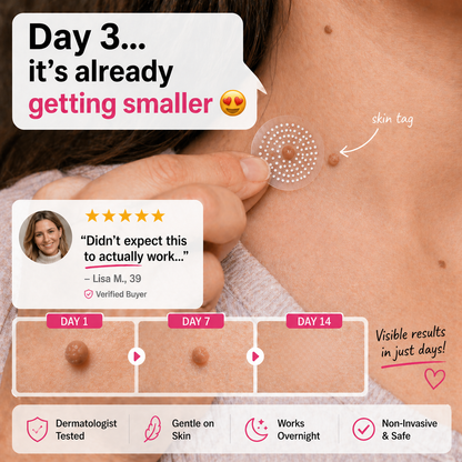 KUBOZN® Pro MicroDarts TAG™ — Patch per Fibromi Cutanei (offer)