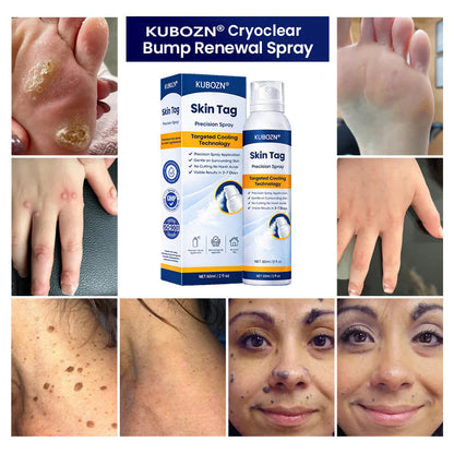 KUBOZN® CryoClear— Precision Cryo Spray for Skin Tag Removal