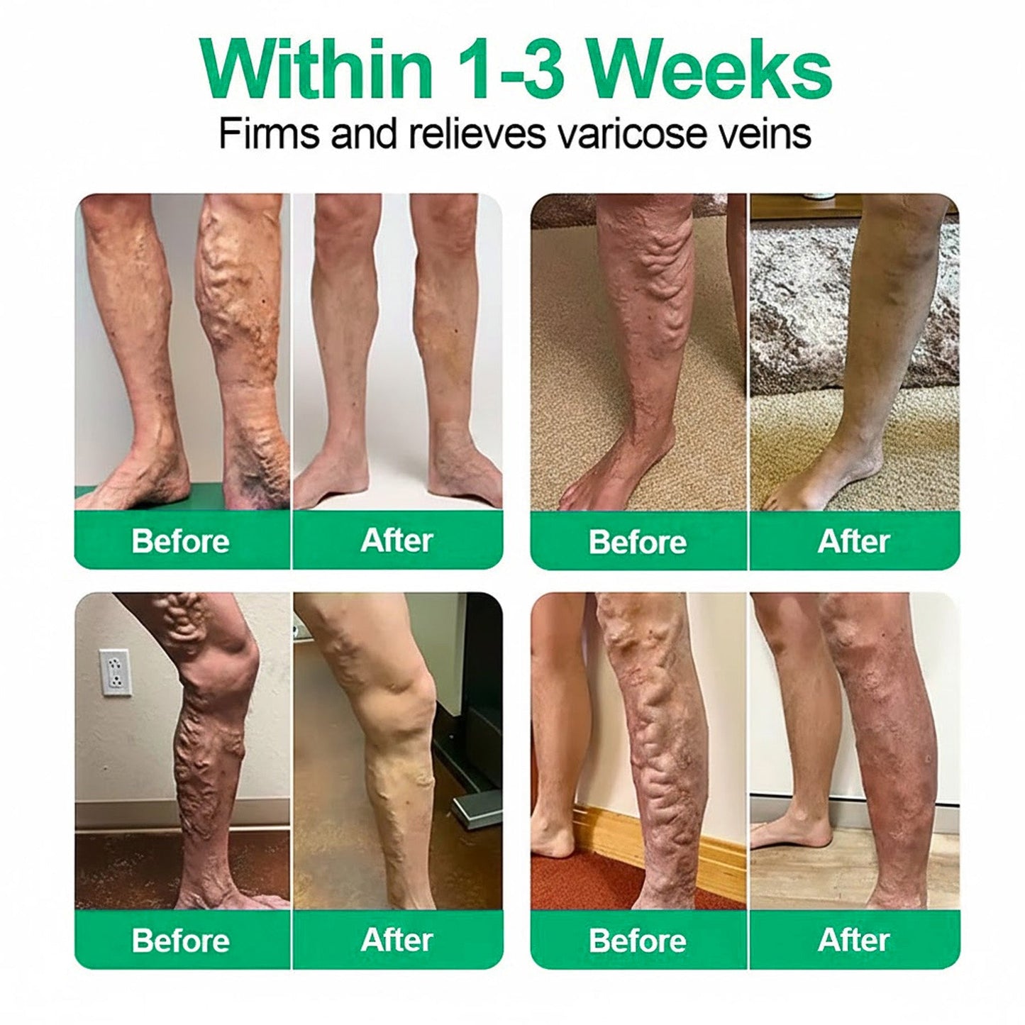 👨‍⚕️🔥 Healrize® VeinEase Patch — ⚡Sollievo Rapido e Duraturo(offer)