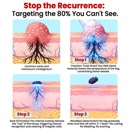 KUBOZN® CryoClear— Precision Cryo Spray for Skin Tag Removal