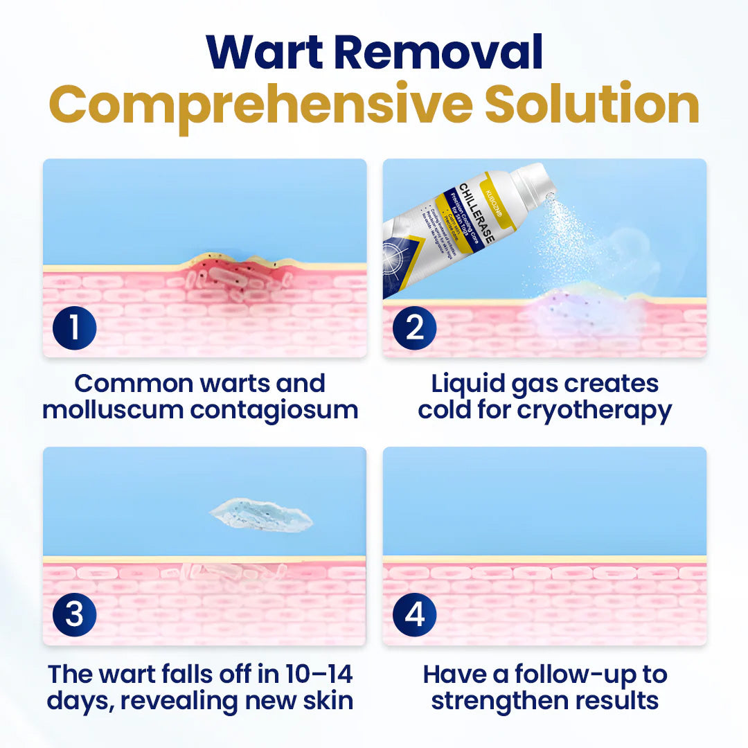 KUBOZN® ChillErase Cooling Spray for Skin Tags 🅱︎